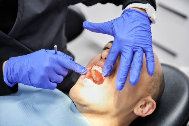 Best Emergency Tooth Extraction in Amherst, VA