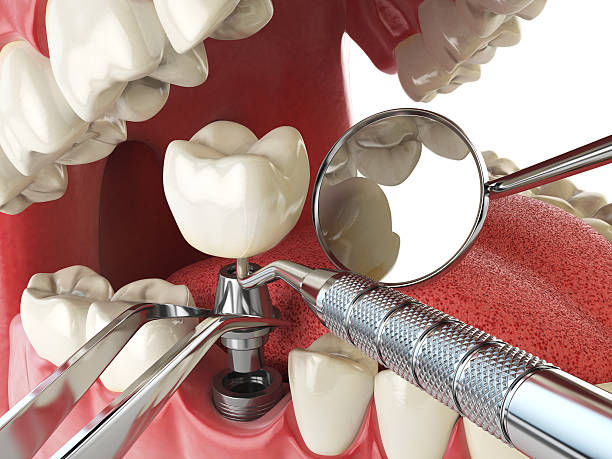Best Emergency Orthodontic Repairs in Amherst, VA