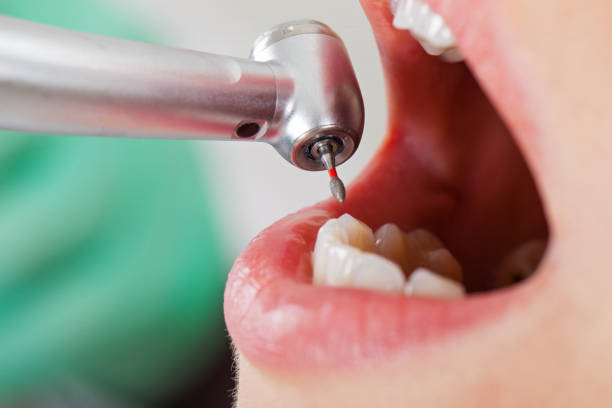 Best Emergency Dental Care for Trauma or Injury in Amherst, VA
